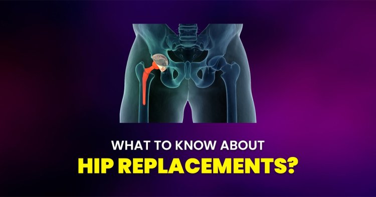 What to know about hip replacements?